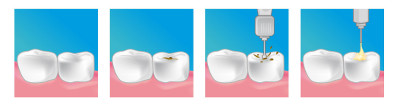 soins dentaires dentiste evreux
